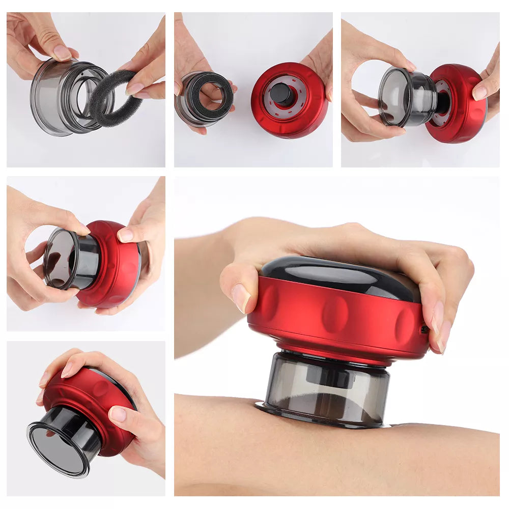 Electric Oriental Vacuum Cupping Self Massager - FitZone360