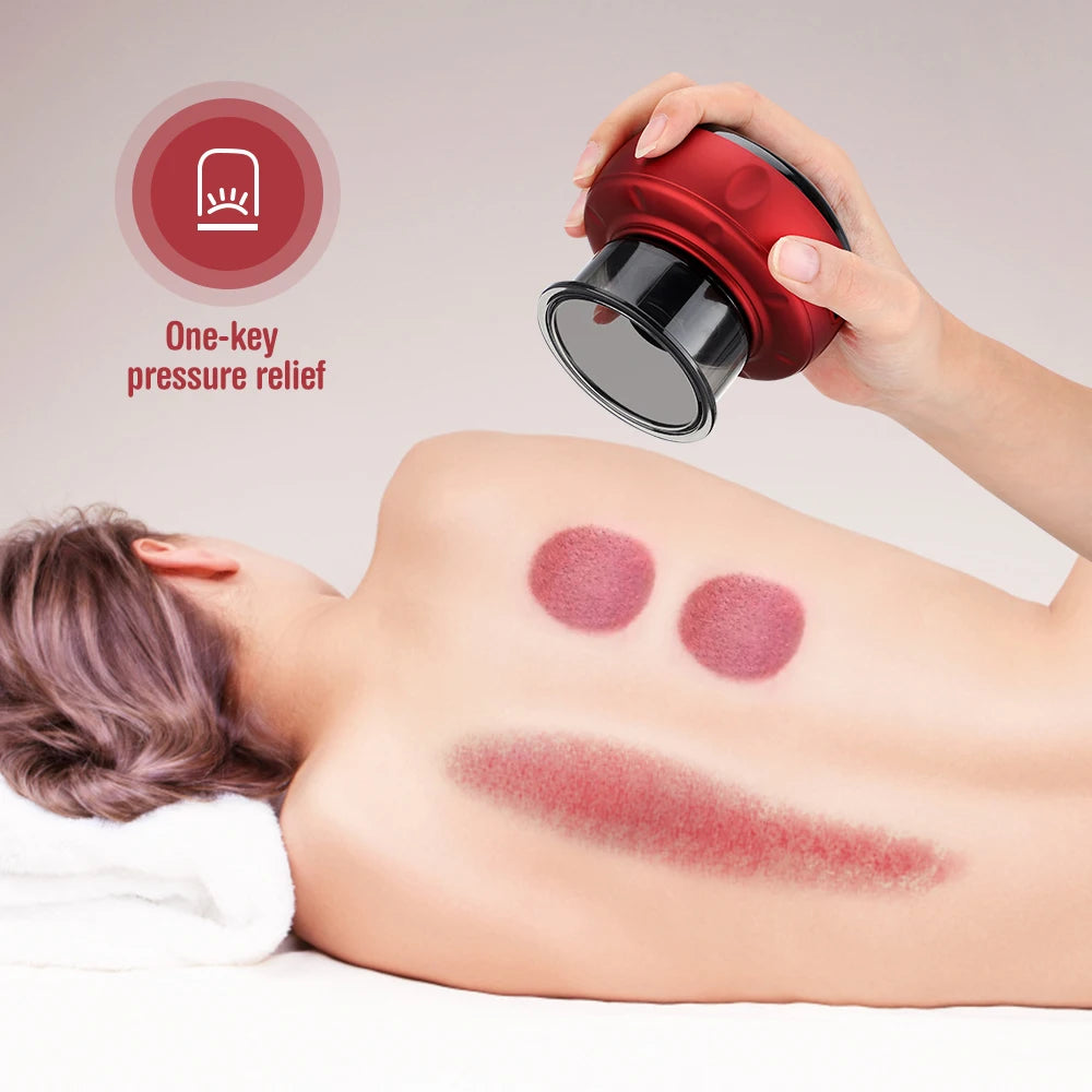 Electric Oriental Vacuum Cupping Self Massager - FitZone360