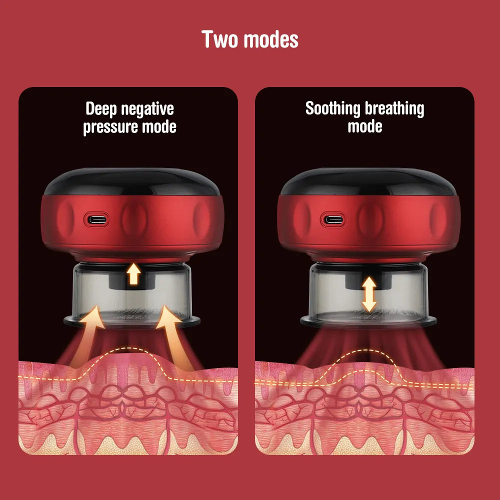 Electric Oriental Vacuum Cupping Self Massager - FitZone360