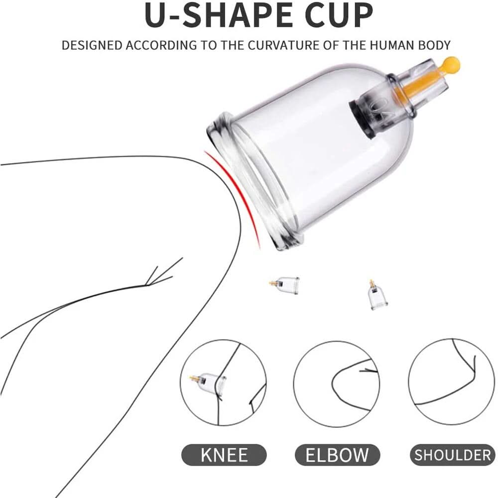 Chinese Cupping Therapy Set | Traditional Wellness & Relaxation - FitZone360