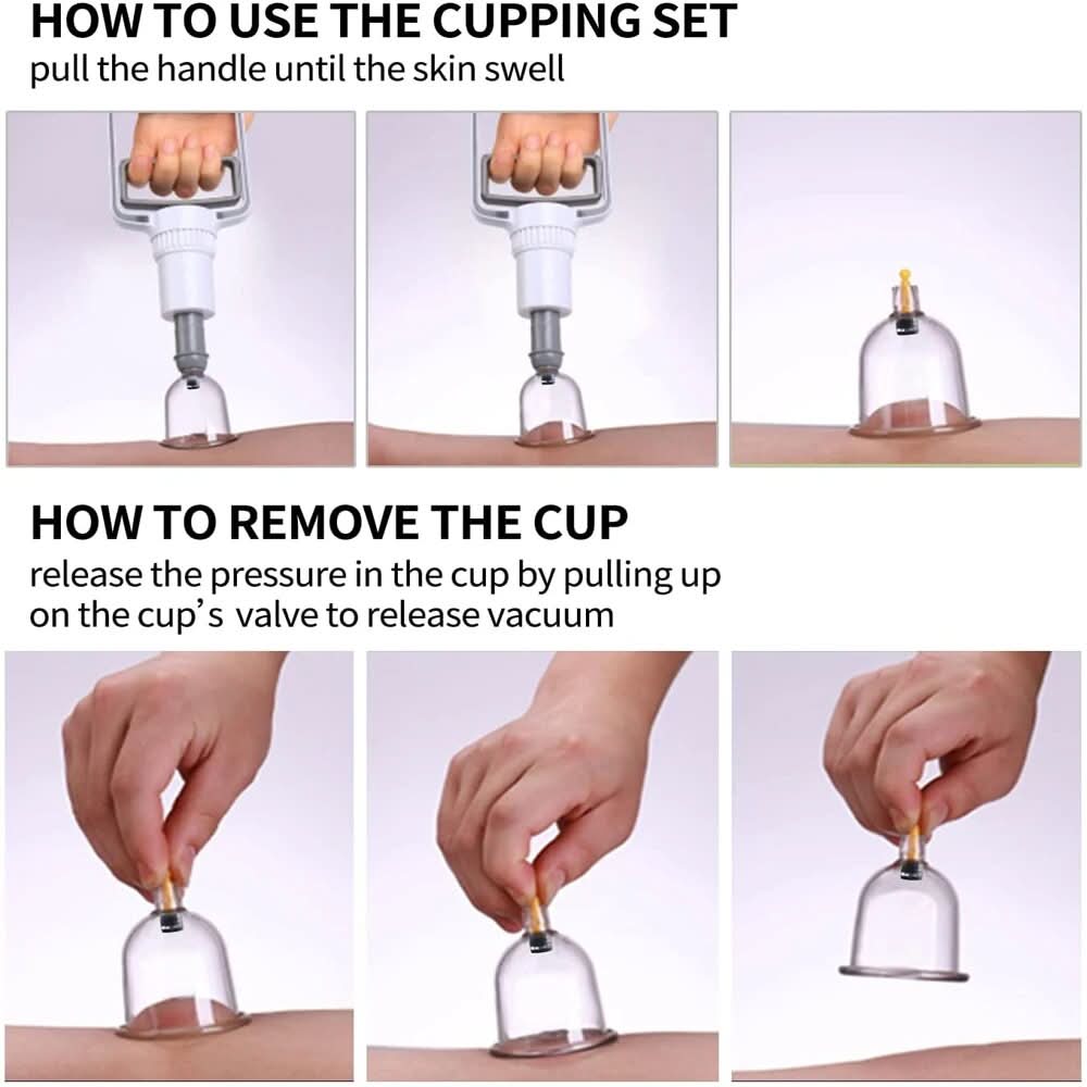 Chinese Cupping Therapy Set | Traditional Wellness & Relaxation - FitZone360