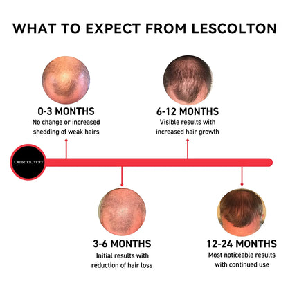 "Infrared Laser Hair Growth Helmet | FDA-Cleared LLLT Therapy for Hair Regrowth" - FitZone360