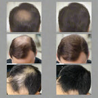 Hair Fibers Keratin Thickening Spray | Instant Fuller, Thicker Hair - FitZone360