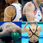Chinese Cupping Therapy Set | Traditional Wellness & Relaxation - FitZone360